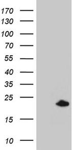SPANXB1 Antibody in Western Blot (WB)