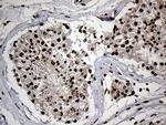 SPANXB1 Antibody in Immunohistochemistry (Paraffin) (IHC (P))
