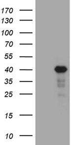 LIMS2 Monoclonal Antibody (OTI5H8)