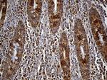 FAM54A Monoclonal Antibody (OTI1A7)