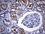 FHIT Antibody in Immunohistochemistry (Paraffin) (IHC (P))