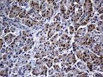 FHIT Antibody in Immunohistochemistry (Paraffin) (IHC (P))