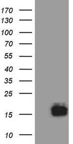 TFF3 Antibody in Western Blot (WB)