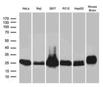 UQCRFS1 Antibody in Western Blot (WB)