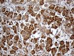 HDHD3 Antibody in Immunohistochemistry (Paraffin) (IHC (P))