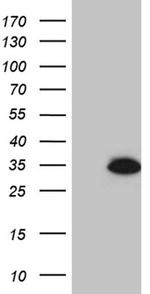 HDHD3 Antibody in Western Blot (WB)