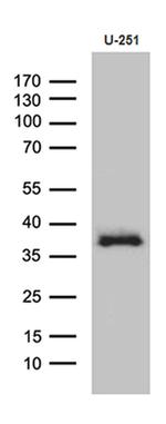 DTWD1 Antibody in Western Blot (WB)