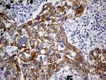 LAD1 Antibody in Immunohistochemistry (Paraffin) (IHC (P))