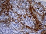 LAD1 Antibody in Immunohistochemistry (Paraffin) (IHC (P))