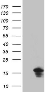 eIF4E3 Antibody in Western Blot (WB)