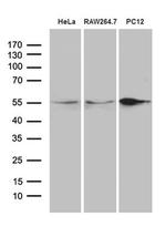 SNX4 Monoclonal Antibody (OTI1B1)