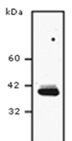 SCD Antibody in Western Blot (WB)