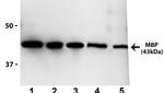 Maltose Binding Protein Monoclonal Antibody (MBP61R)