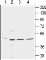 KCNN4 (extracellular) Antibody in Western Blot (WB)