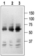 NGFR (extracellular) Antibody in Western Blot (WB)