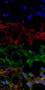 Acrolein Monoclonal Antibody (10A10)