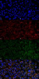 Hexanoyl-Lysine adduct Monoclonal Antibody (5E8)