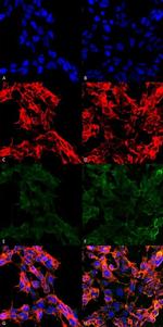 7-Ketocholesterol Antibody in Immunocytochemistry (ICC/IF)