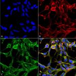 Nitrotryptophan Antibody in Immunocytochemistry (ICC/IF)
