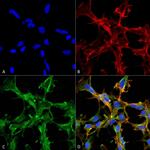 Citrulline Monoclonal Antibody (2D3.1)