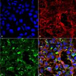 Dityrosine Monoclonal Antibody (7D4)