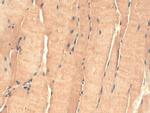 p23 Antibody in Immunohistochemistry (IHC)