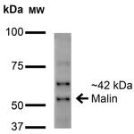 NHLRC1 Antibody in Western Blot (WB)
