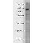 KCNT2 Antibody in Western Blot (WB)