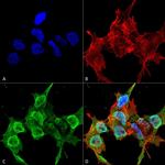 SYT12 Antibody in Immunocytochemistry (ICC/IF)