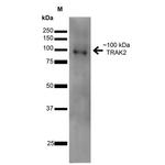TRAK2 Antibody in Western Blot (WB)