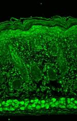 HIF1AN Antibody in Immunohistochemistry (Paraffin) (IHC (P))