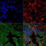 ADAM22 Antibody in Immunocytochemistry (ICC/IF)