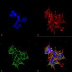 REEP2 Antibody in Immunocytochemistry (ICC/IF)