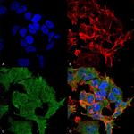 SHANK2 Antibody in Immunocytochemistry (ICC/IF)