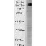 SHANK2 Antibody in Western Blot (WB)