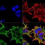 SUR1/SUR2B Antibody in Immunocytochemistry (ICC/IF)
