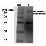 SUR1/SUR2B Antibody in Western Blot (WB)