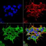 Stargazin Antibody in Immunocytochemistry (ICC/IF)