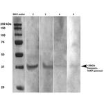 Stargazin Antibody in Western Blot (WB)