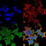 LGI1 Monoclonal Antibody (N283/7)