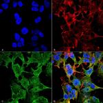 SCN2B Antibody in Immunocytochemistry (ICC/IF)