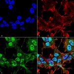 PHYH Antibody in Immunocytochemistry (ICC/IF)
