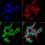 PEX6 Antibody in Immunocytochemistry (ICC/IF)