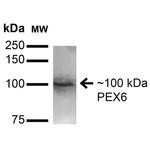 PEX6 Antibody in Western Blot (WB)