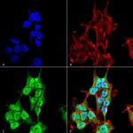 INPP5F Antibody in Immunocytochemistry (ICC/IF)