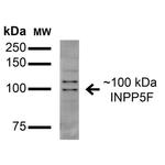 INPP5F Antibody in Western Blot (WB)