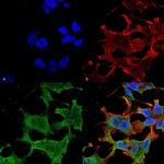 LRP4 Antibody in Immunocytochemistry (ICC/IF)