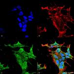 KV3.2 (KCNC2) Antibody in Immunocytochemistry (ICC/IF)
