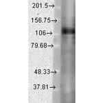 KV3.1 (KCNC1) Antibody in Western Blot (WB)