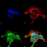 GRK5 Antibody in Immunocytochemistry (ICC/IF)